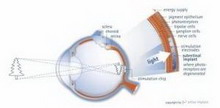 будущее глазной хирургии